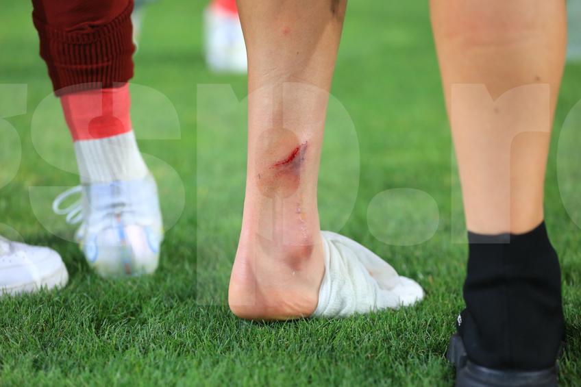 Albion Rrahmani a ieșit accidentat în Rapid - CFR Cluj 2-2. Foto: Ionuț Iordache (GSP)