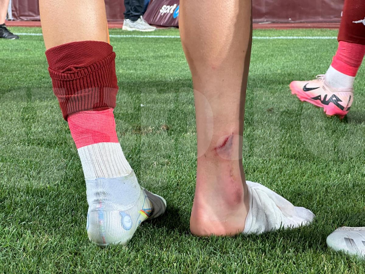 Medicii au anunțat verdictul în cazul lui Albion Rrahmani, ieșit în lacrimi de pe teren în Rapid - CFR Cluj