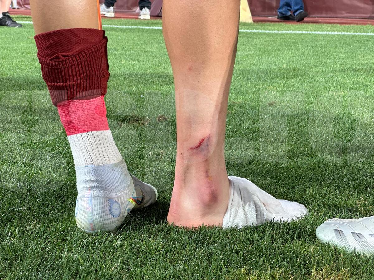 Medicii au anunțat verdictul în cazul lui Albion Rrahmani, ieșit în lacrimi de pe teren în Rapid - CFR Cluj