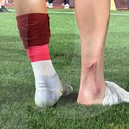 Albion Rrahmani a ieșit accidentat în Rapid - CFR Cluj 2-2. Foto: Ionuț Iordache (GSP)