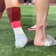 Albion Rrahmani a ieșit accidentat în Rapid - CFR Cluj 2-2. Foto: Ionuț Iordache (GSP)