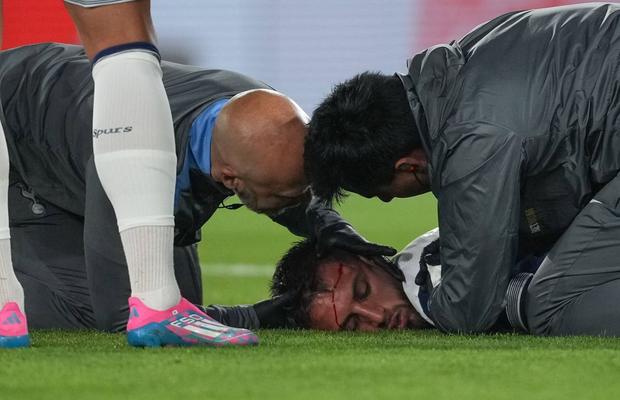 Radu Drăgușin, martor la o accidentare horror » Dramă pe gazon. A fost scos cu masca pe figură