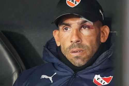 Carlos Tevez a avut amețeli și a căzut în cadă, rănindu-se la cap. Foto: Ole.com