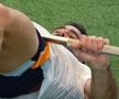 Piciorul lui Dani Carvajal după operație