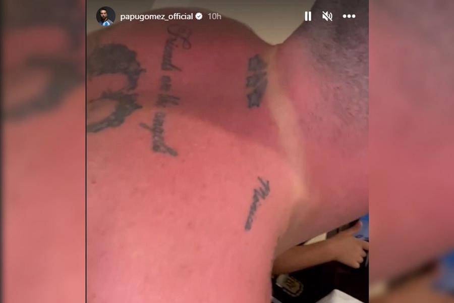 Medalia de câștigător l-a „salvat”, parțial, pe Papu Gomez. Acolo nu a fost ars de soare „Am nevoie de aloe vera” » Sărbătoarea de titlu a Argentinei l-a lăsat cu urme pe Papu Gomez