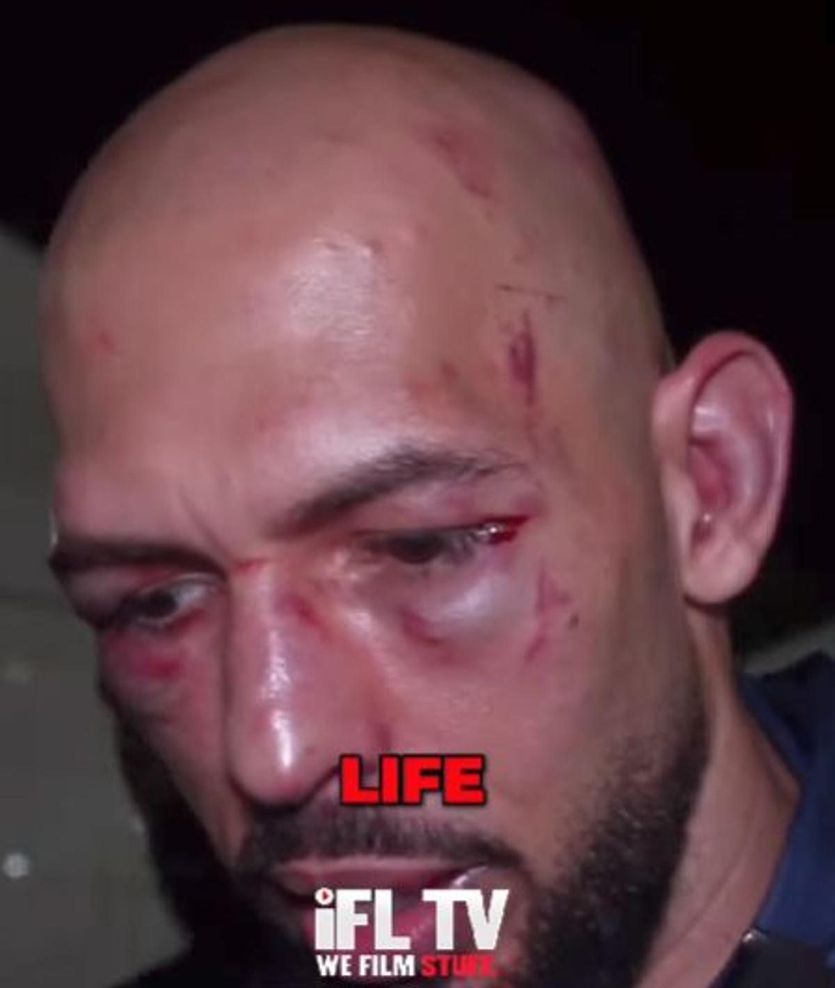 După 5 ani, Andrew Tate a revenit în ring! Un actor l-a umplut de sânge: „Trebuia să-mi înfrunt frica”