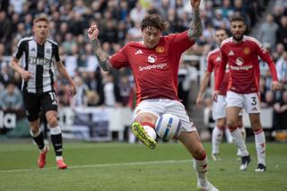 Vedeta lui Manchester United a plecat brusc la pauză, direct la spital: „Fruntea lui era despicată în două!”