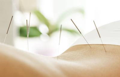 Înțelege conexiunea dintre corp și spirit prin acupunctură !