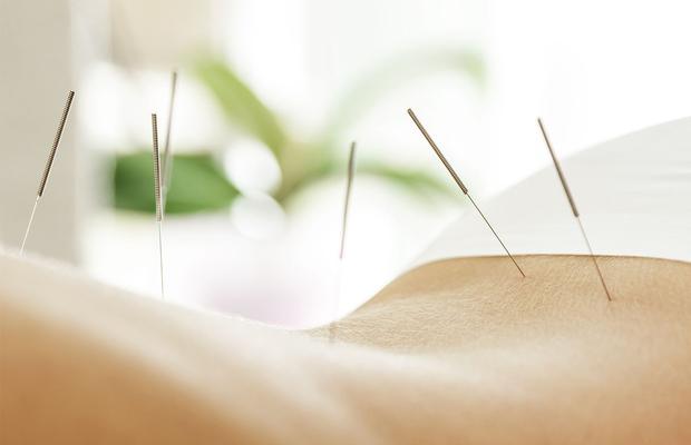 Înțelege conexiunea dintre corp și spirit prin acupunctură !