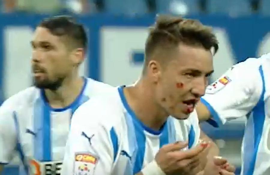 Alexandru Mateiu a ieșit cu dinții sparți de pe teren la meciul cu Gaz Metan din august 2021 La 400 de meciuri în Liga 1, mărturisește: „Asta voi regreta până la moarte” + „Rotaru a venit nervos în vestiar și m-a amendat cu 2.000 de euro”