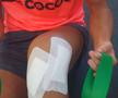 Valentin Țicu (Petrolul) la recuperare după accidentare