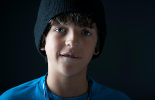 Aparatele dentare și sporturile: cum îți protejezi dantura în timp ce te joci