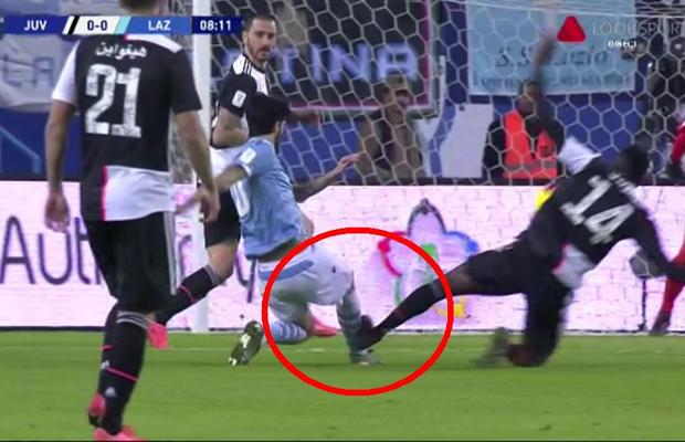 FOTO Intrare horror în Juventus - Lazio! Putea să îi rupă piciorul, dar arbitrul nu a dat nici măcar fault