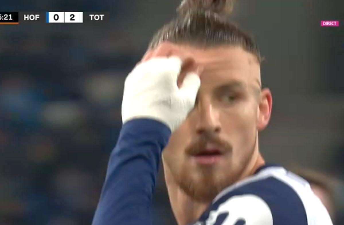 „New look” pentru Radu Drăgușin cu Hoffenheim, la 4 zile după ce a fost umplut de sânge