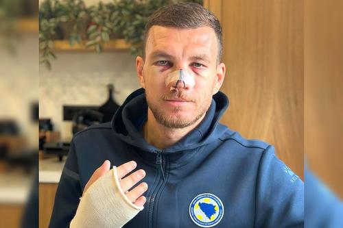 Edin Dzeko, desfigurat de Mihai Popescu în România - Bosnia