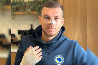 Edin Dzeko, apariție șocantă după ce Mihai Popescu i-a dat un șut în față. Mario Balotelli a intervenit