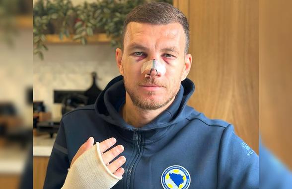 Edin Dzeko, apariție șocantă după ce Mihai Popescu i-a dat un șut în față. Mario Balotelli a intervenit
