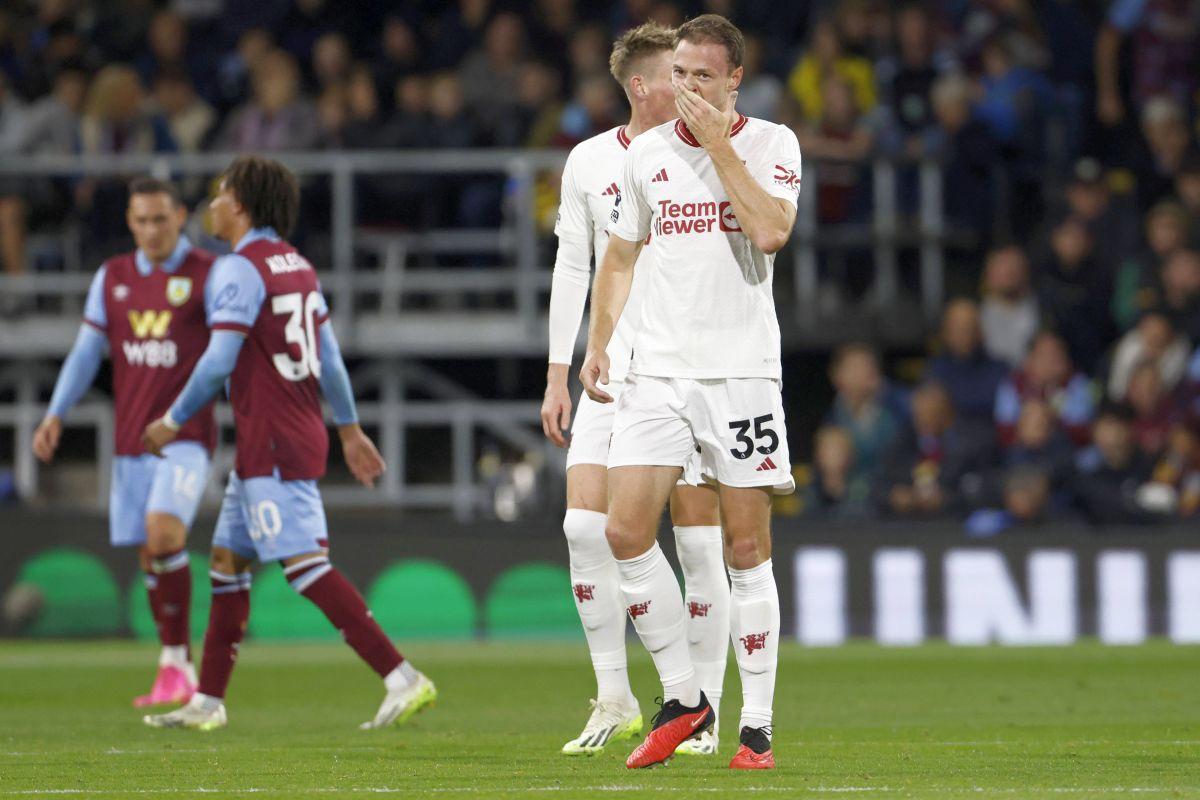 Burnley - Manchester United