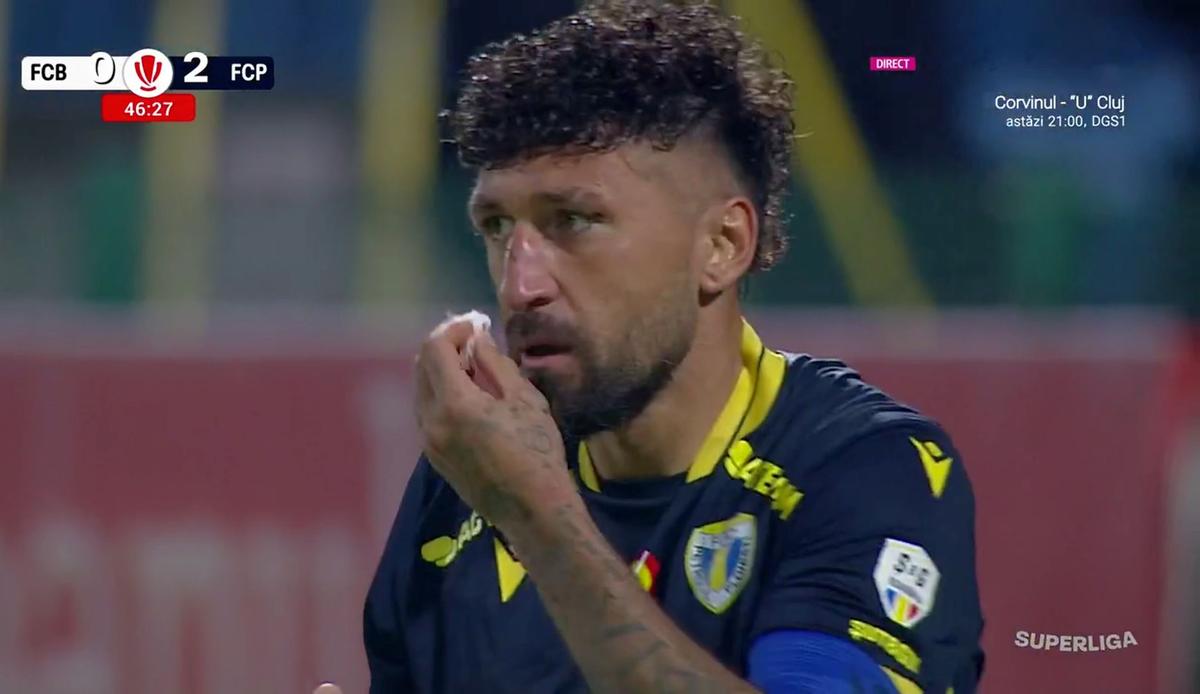 Decizie de neînțeles la Botoșani: talpă în față sub ochii arbitrului, dar nu a fost eliminat!