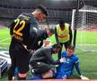 UPDATE // Silviu Lung jr, scos de pe teren după o repriză incredibilă cu Galatasaray » Doctorii nu l-au mai lăsat să apere! Primul verdict