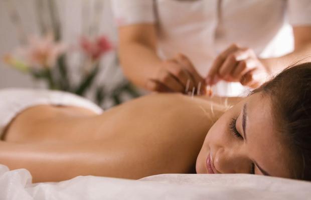 Tot ce trebuie să știi despre acupunctură si tratamentele cu aceasta !