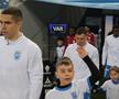 Universitatea Craiova - FC Botoșani // foto: Andrei Furnigă (GSP.ro)