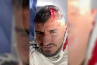 Dinamo recidivează: imagine-șoc cu Romario Benzar după intrarea criminală a lui Abdallah » Diagnosticul pus la spital