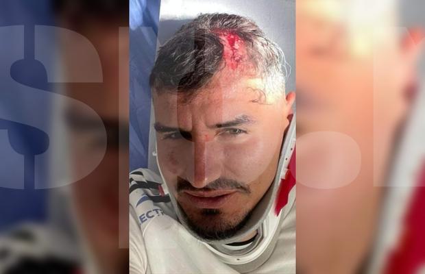 Dinamo recidivează: imagine-șoc cu Romario Benzar după intrarea criminală a lui Abdallah » Diagnosticul pus la spital