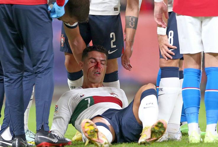 Cristiano Ronaldo, accidentat în Cehia - Portugalia / Sursă foto: Imago Images