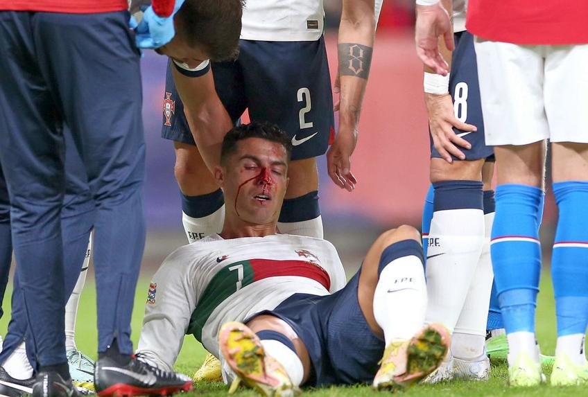 Cristiano Ronaldo, accidentat în Cehia - Portugalia / Sursă foto: Imago Images