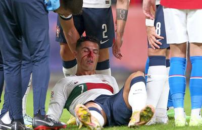 Cristiano Ronaldo și-a spart nasul în meciul Portugaliei + Lovitură de teatru la Zaragoza: Elveția câștigă în Spania » Cum arată clasamentul