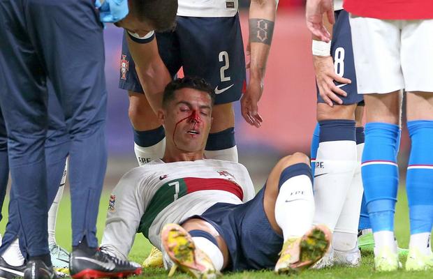 Cristiano Ronaldo și-a spart nasul în meciul Portugaliei + Lovitură de teatru la Zaragoza: Elveția câștigă în Spania » Cum arată clasamentul
