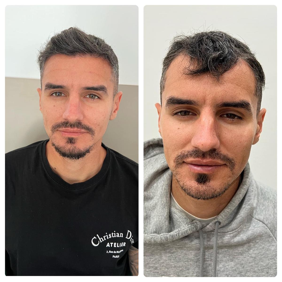 FOTO Romario Benzar, implant de păr și imagini cu Bianca, soția lui