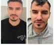Fotbalistul pe care Becali a luat 2 milioane de euro și-a făcut implant de păr » Imagini spectaculoase: cum arată înainte și după intervenție