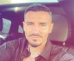 Fotbalistul pe care Becali a luat 2 milioane de euro și-a făcut implant de păr » Imagini spectaculoase: cum arată înainte și după intervenție