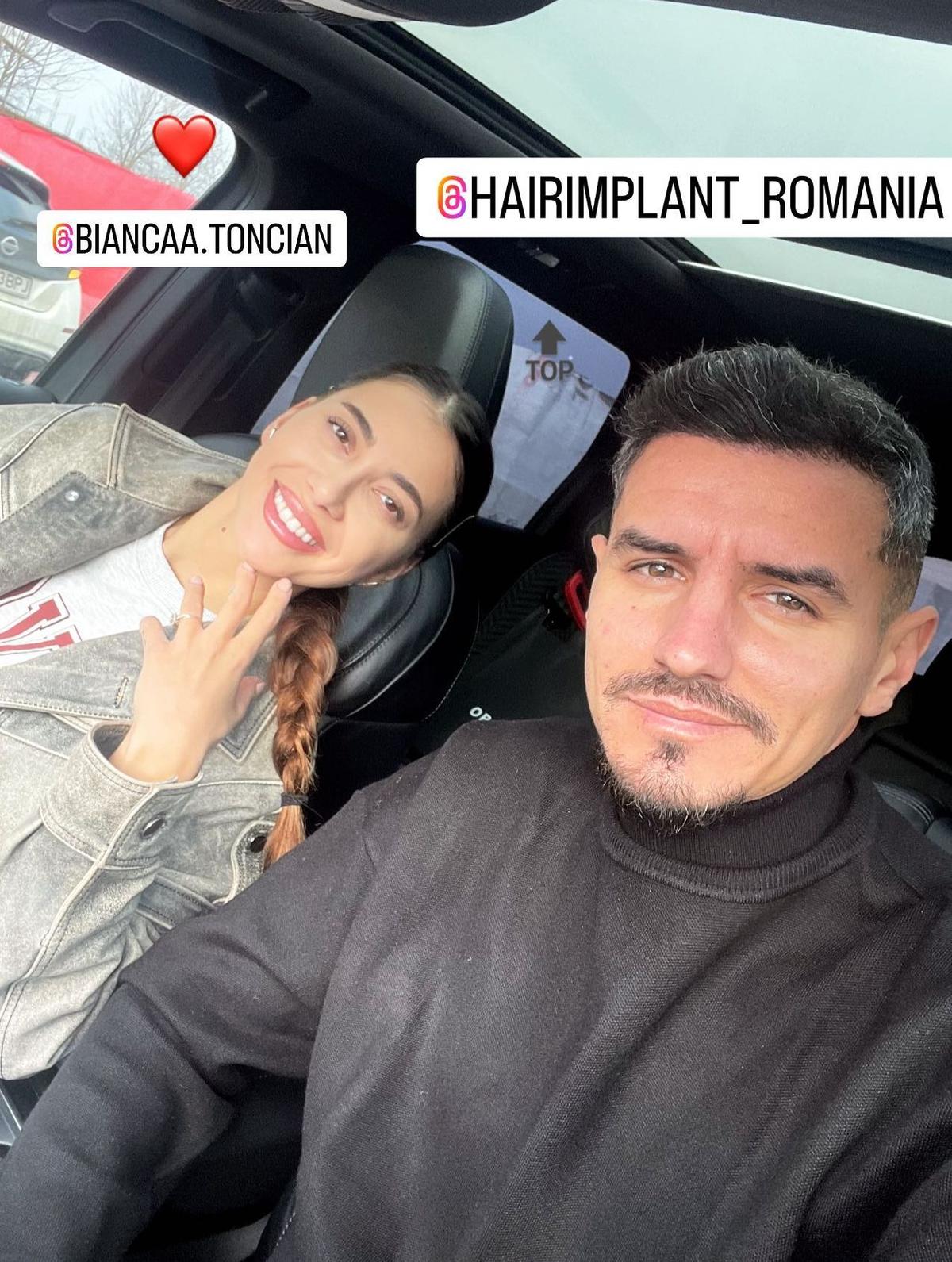 Fotbalistul pe care Becali a luat 2 milioane de euro și-a făcut implant de păr » Imagini spectaculoase: cum arată înainte și după intervenție