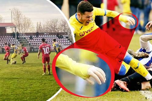 Caz revoltător în Liga 3: Fotbalistul cu proteză, care a făcut înconjurul lumii, acuză că a fost umilit în meciul cu echipa care l-a crescut: „«Mânuță», te-a călcat trenul? Băga-mi-aș p**a în mâna ta” // fotomontaj: Diana Vasilescu (GSP)
