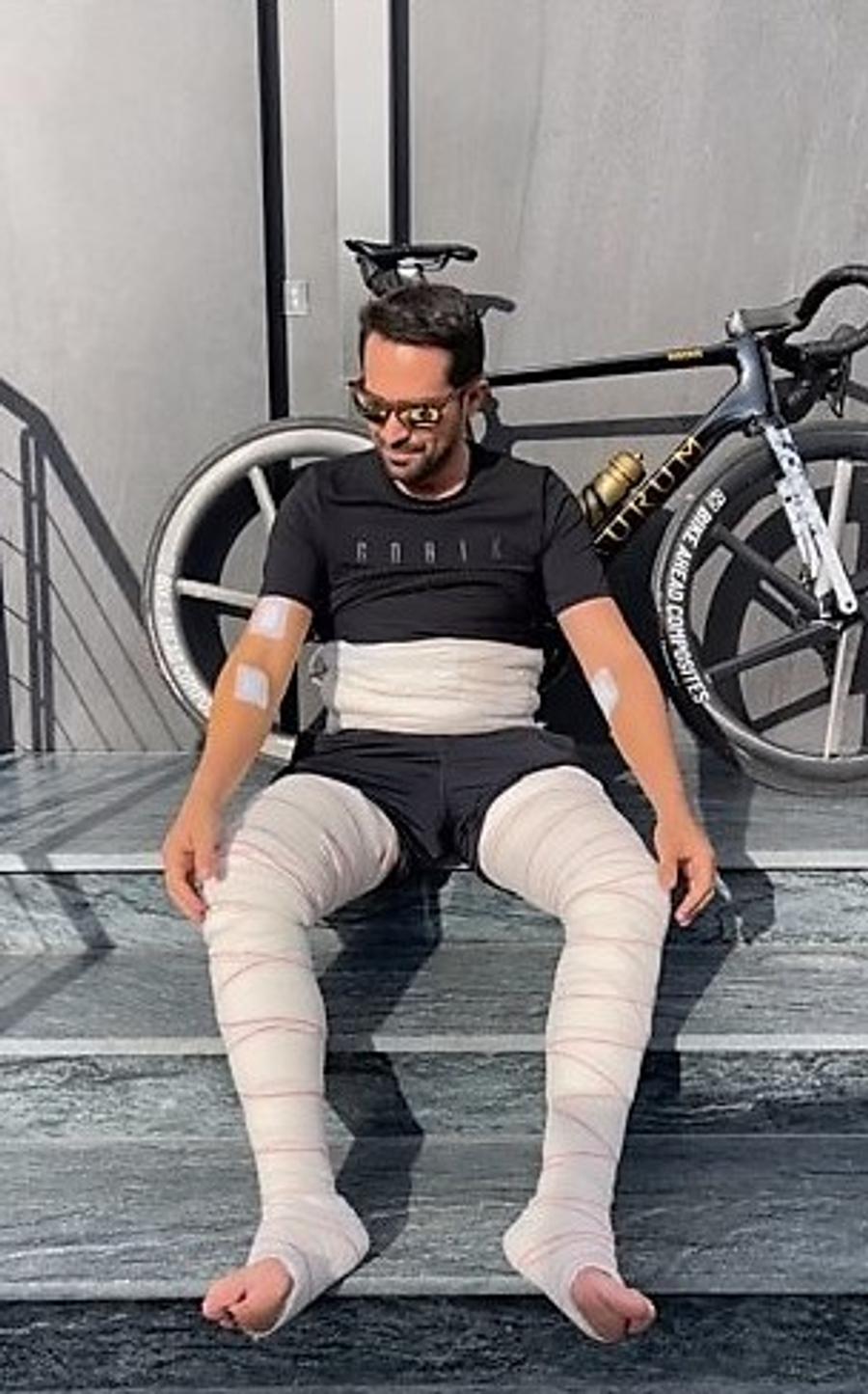 „,Am 70 de tăieturi pe corp”. Contador s-a operat de Crăciun și a postat o imagine tulburătoare pe Instagram