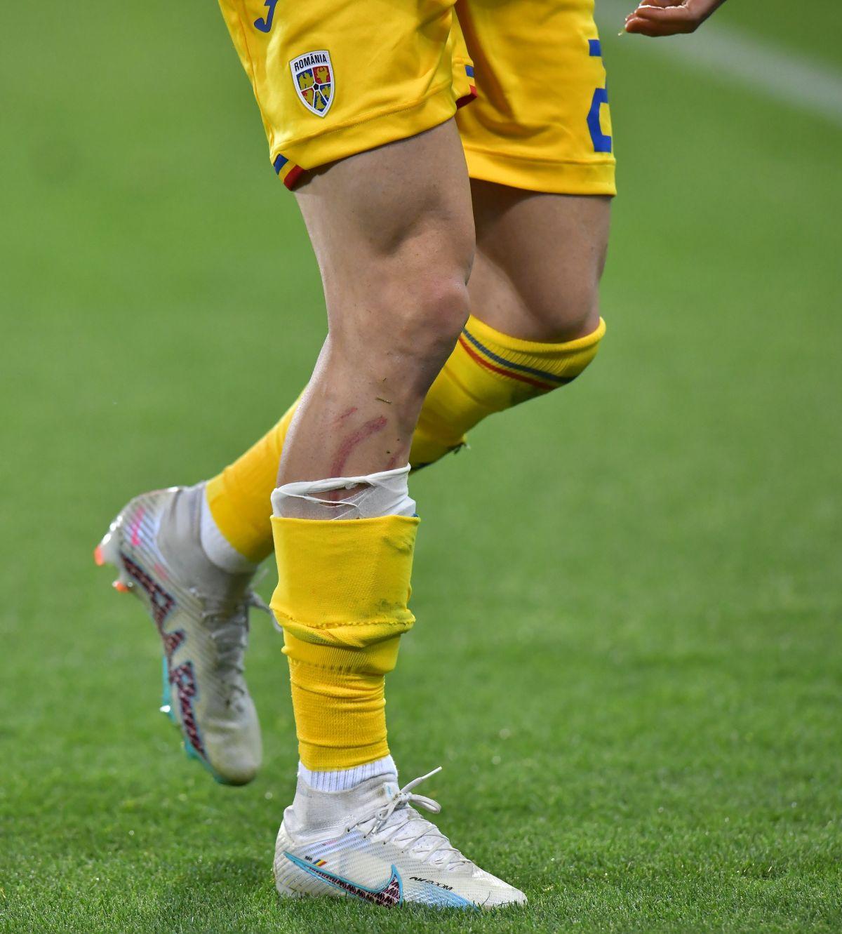 Meciul Andorra - România, din preliminariile EURO 2024