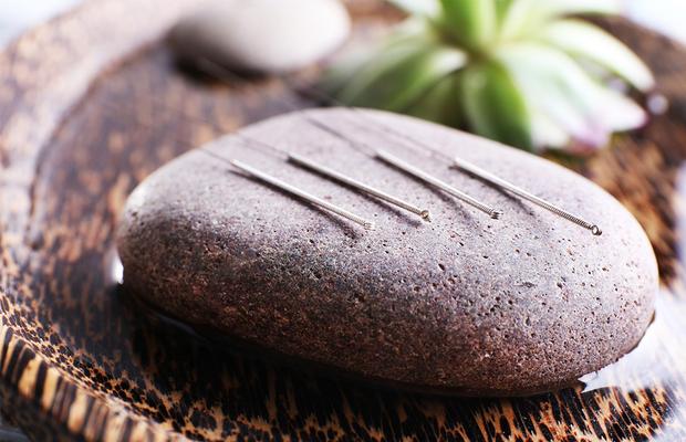 Cum ne ajută acupunctură în diverse afecțiuni?
