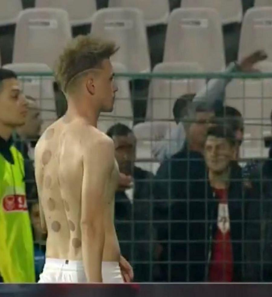 Claudiu Petrila, după meciul FCSB - CFR 3-1 Urmele de pe spatele lui Petrila la Buzău: „Dopaj fiziologic” » Mijlocașul campioanei, precum Benzema și Phelps!