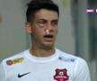 Mihai Butean (25 de ani), fundașul dreapta de la Hermannstadt, a fost lovit în față în prima repriza a meciului cu Chindia, la scorul de 1-1.
