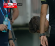 Atenție, imagini dure în Liga 1: hemoragie nazală și hematom pronunțat după o lovitură nesancționată de arbitri