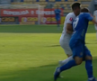 Atenție, imagini dure în Liga 1: hemoragie nazală și hematom pronunțat după o lovitură nesancționată de arbitri