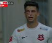 Atenție, imagini dure în Liga 1: hemoragie nazală și hematom pronunțat după o lovitură nesancționată de arbitri