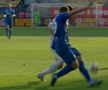 Atenție, imagini dure în Liga 1: hemoragie nazală și hematom pronunțat după o lovitură nesancționată de arbitri