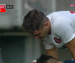 Atenție, imagini dure în Liga 1: hemoragie nazală și hematom pronunțat după o lovitură nesancționată de arbitri