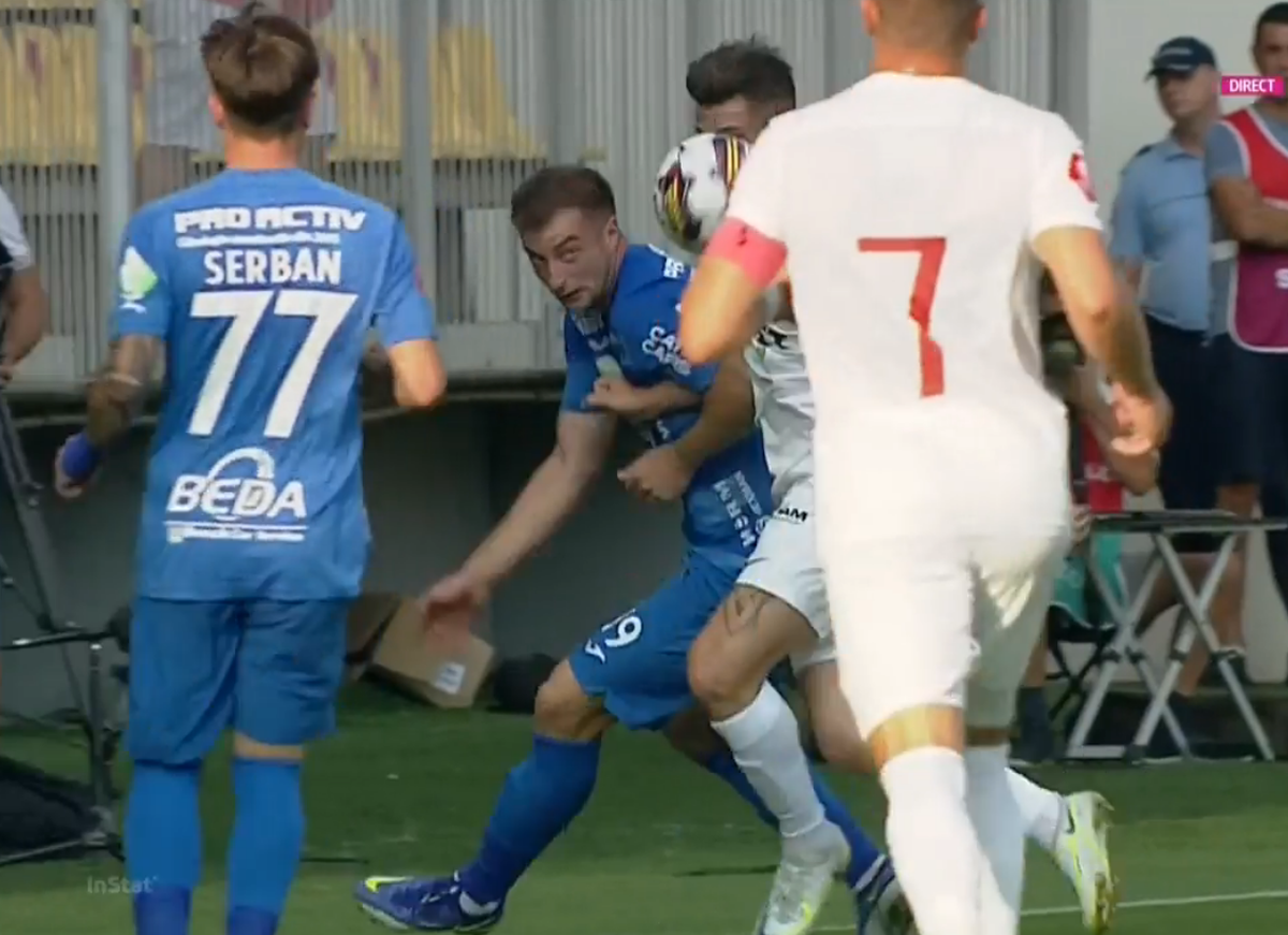 Atenție, imagini dure în Liga 1: hemoragie nazală și hematom pronunțat după o lovitură nesancționată de arbitri
