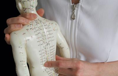 Acupunctura: ce este și când este indicat să apelezi la un tratament acupunctura?