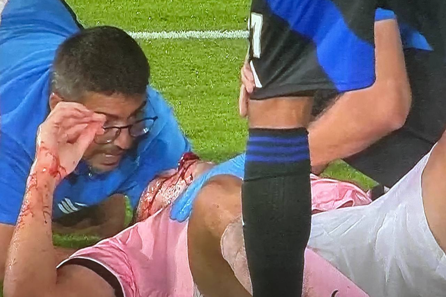 Accidentarea horror a lui Ionuț Nedelcearu / Foto: Twitter Ionuț Nedelcearu și-a dat autogol, apoi a suferit o accidentare horror: „Nu se simte bine”